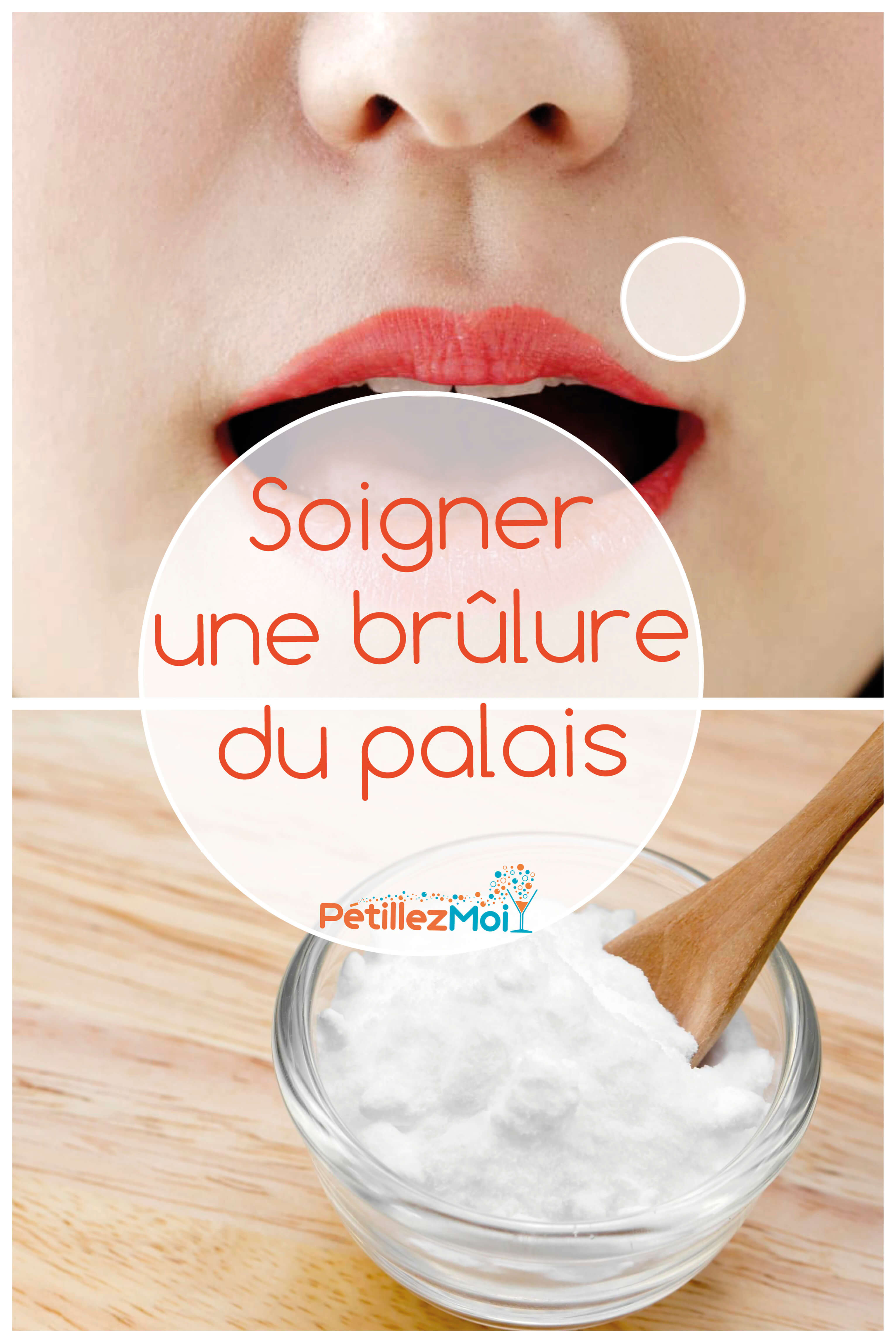 Soigner une brûlure du palais